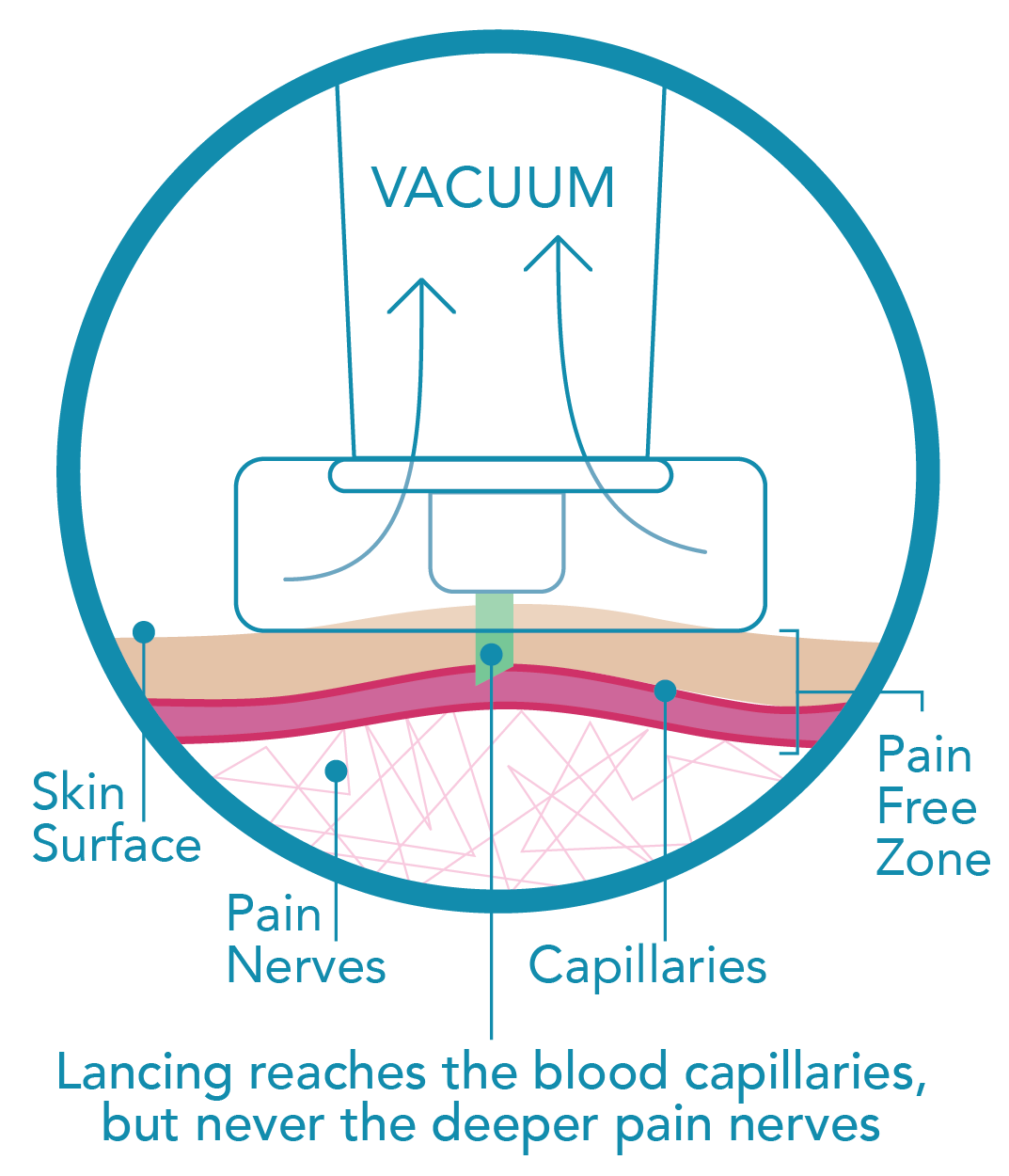 Genteel® Lancing Device