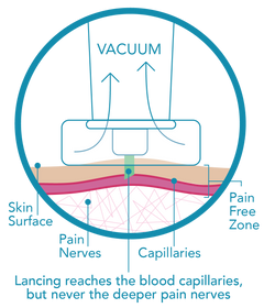 Genteel® Lancing Device