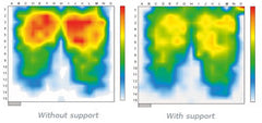 PolyAir cushions for very high risk pressure ulcers